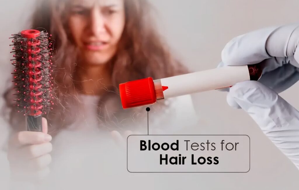blood test for hair loss